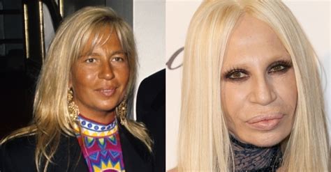 donatella versace antes e depois